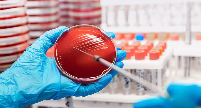 Des mains portant des gants de laboratoire tiennent une plaque de gélose et une pipette. En arrière-plan se trouvent d’autres plaques de gélose et des éprouvettes d’échantillons.